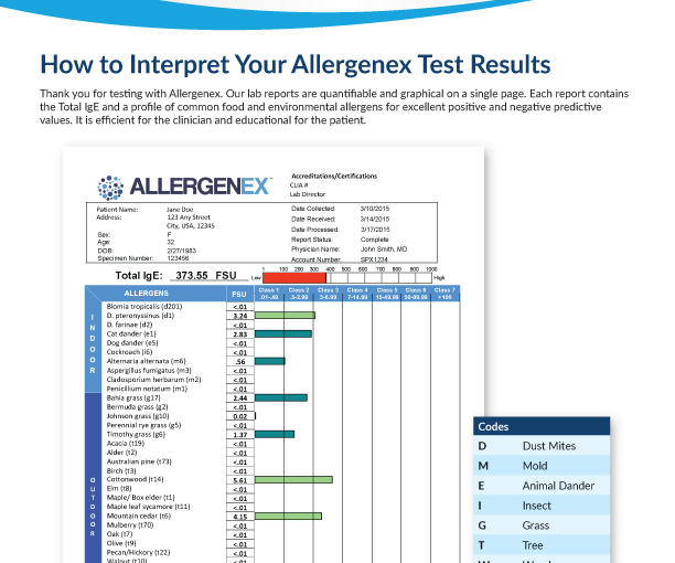 How to Interpret AGX Results